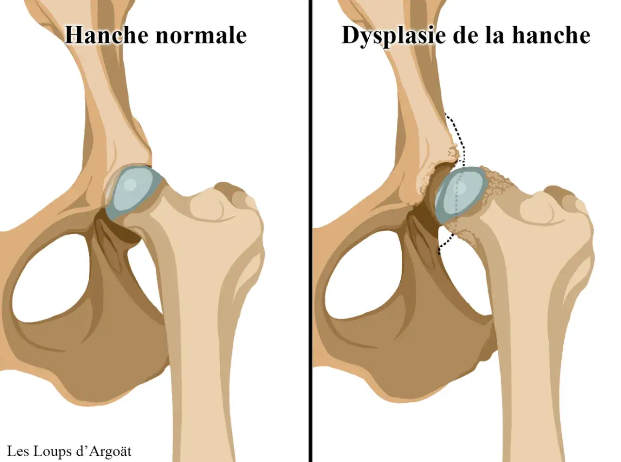 Comparaison de hanches : normale vs. dysplasie. La dysplasie de la hanche affecte souvent les bergers allemands, causant une mauvaise articulation.