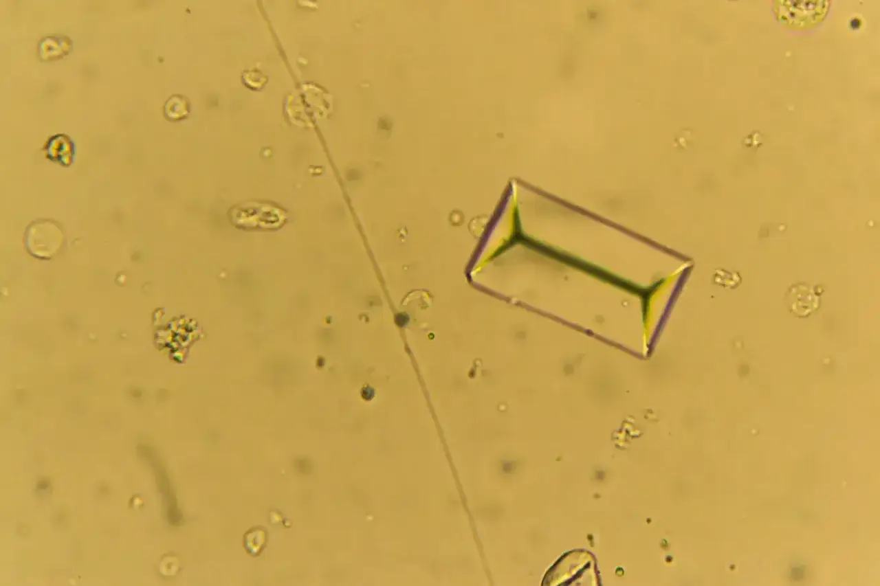 Microscopique, un cristal d'oxalate de calcium en forme de rectangle aux bords violets se d&eacute;tache sur un fond jaune, entour&eacute; de petites cellules rondes.
